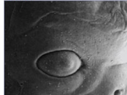 Eyelid formation in the human embryo  at eight weeks of gestation