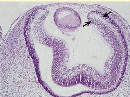 The two layers of the neuroepithelium of the optic cup (arrows) become the anterior and posterior IPE, and the iris stroma is derived from neural crest tissue (hematoxylin-eosin, X63).