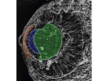 Cross-section of embryonic seven weeks old Orange area is the developing cornea, blue is the lens cavity and green is the posterior lens fibres.